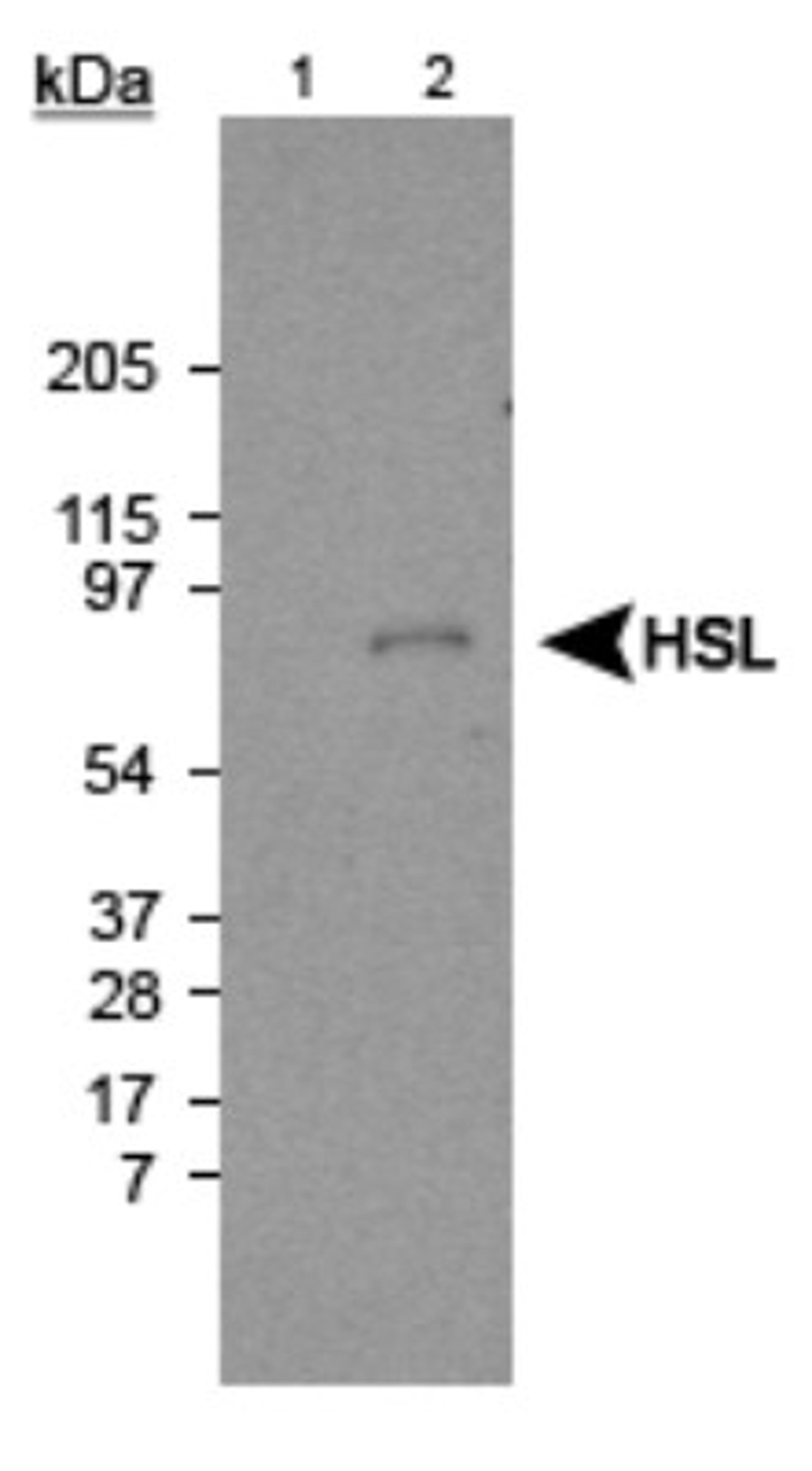 Western Blot: HSL Antibody [NB110-37253] - Detection of HSL using NB110-37253. Lane 1: Liver extract (negative control) Lane 2: Fat extract (10ug) (positive sample).