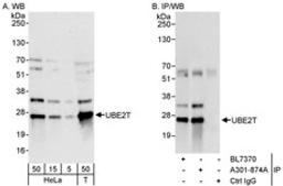 Detection of human UBE2T by western blot and immunoprecipitation.