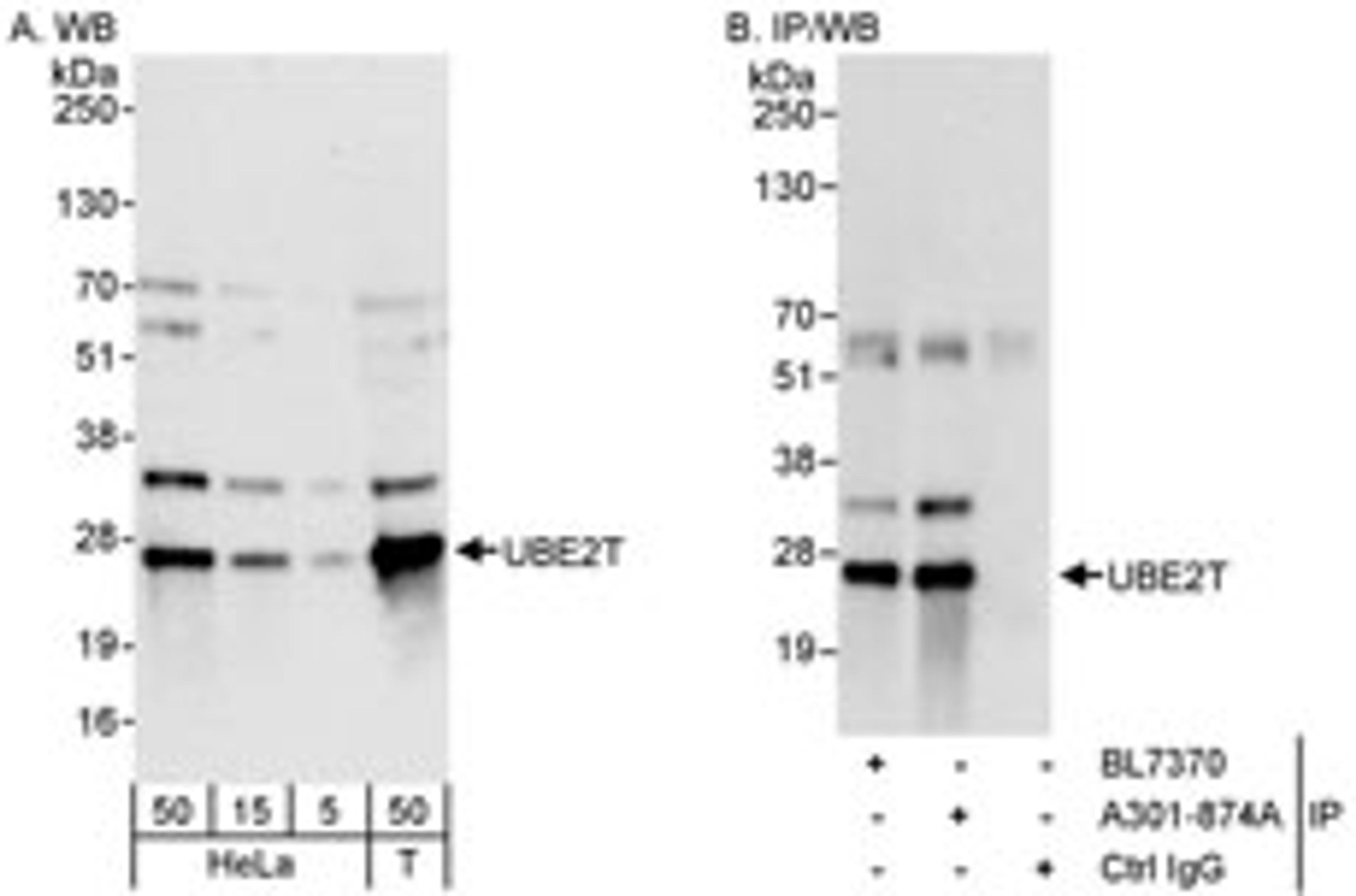 Detection of human UBE2T by western blot and immunoprecipitation.