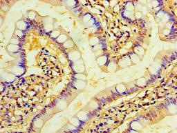 Immunohistochemistry of paraffin-embedded human small intestine tissue using CSB-PA023841HA01HU at dilution of 1:100
