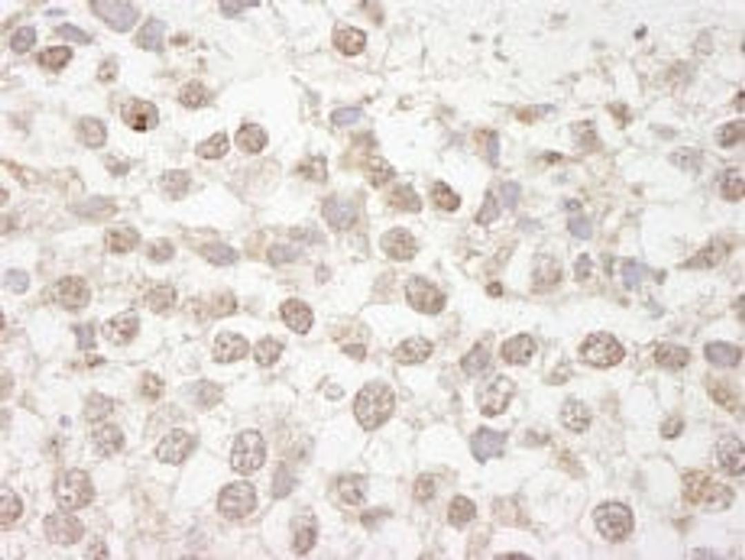 Detection of human MBD4 by immunohistochemistry.