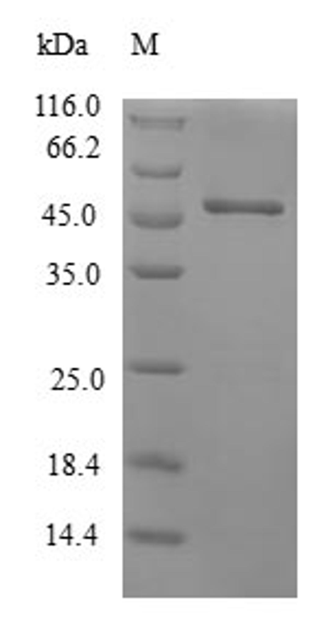 (Tris-Glycine gel) Discontinuous SDS-PAGE (reduced) with 5% enrichment gel and 15% separation gel.