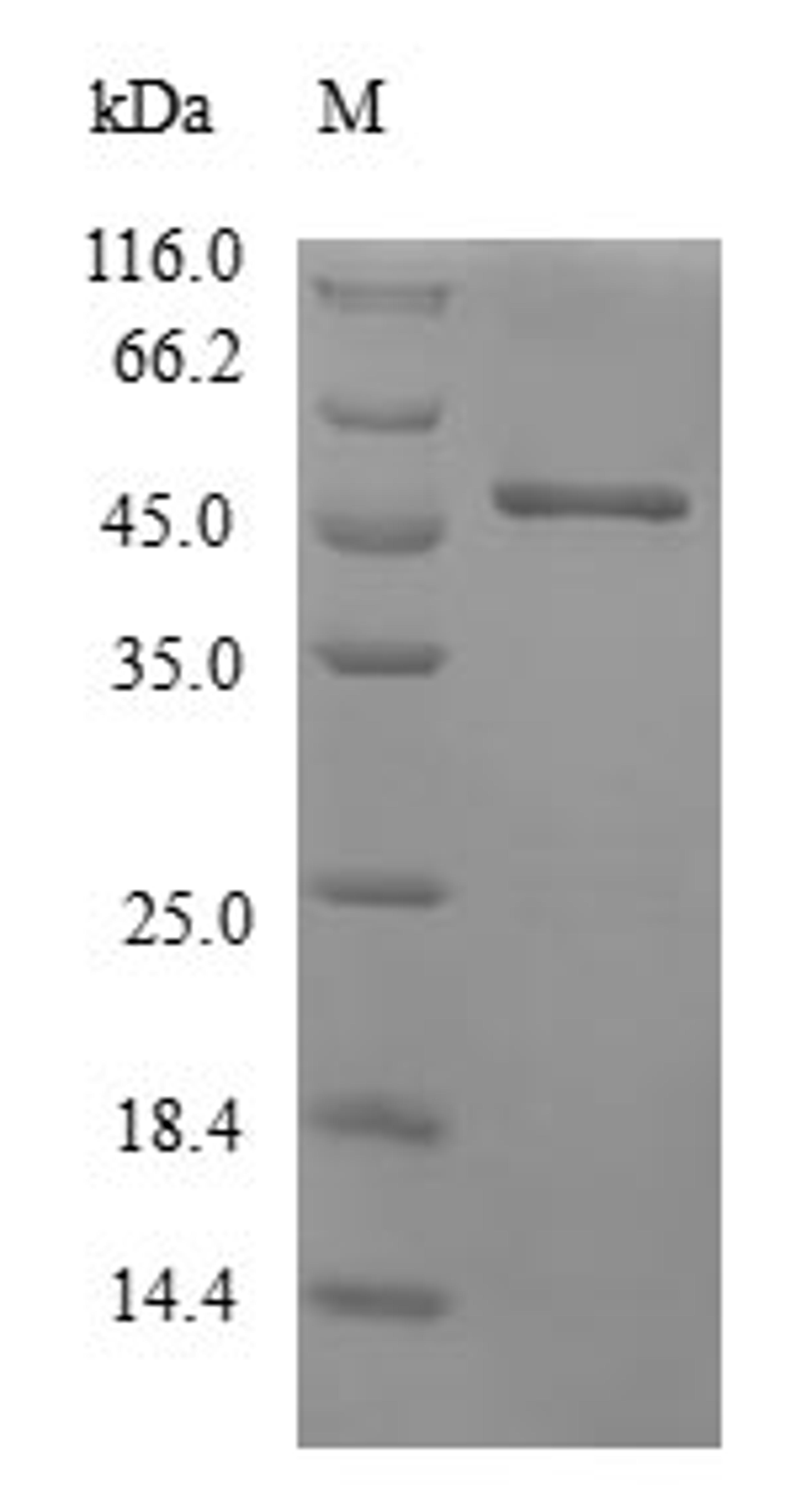 (Tris-Glycine gel) Discontinuous SDS-PAGE (reduced) with 5% enrichment gel and 15% separation gel.