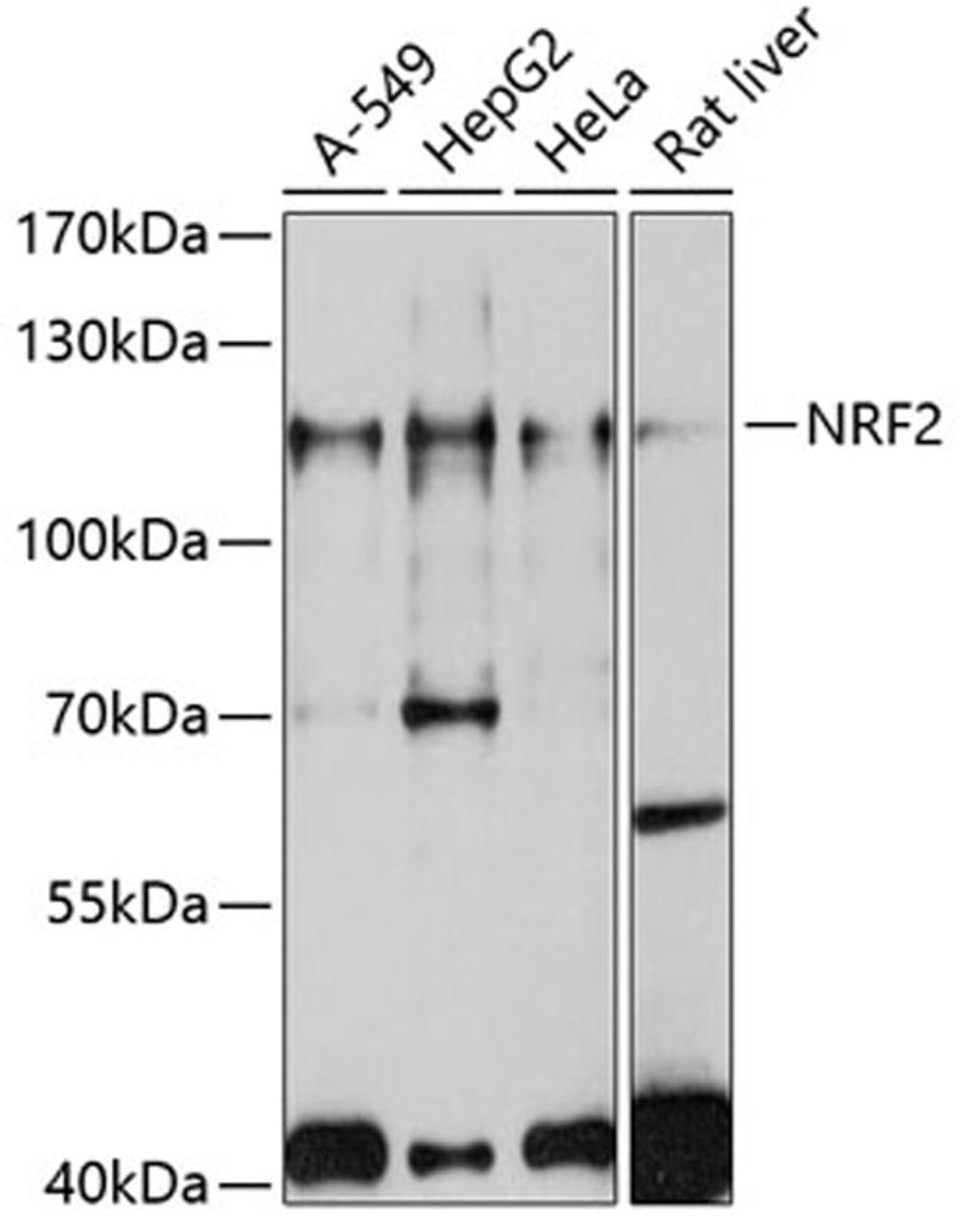 Western blot - NRF2 antibody (A11159)