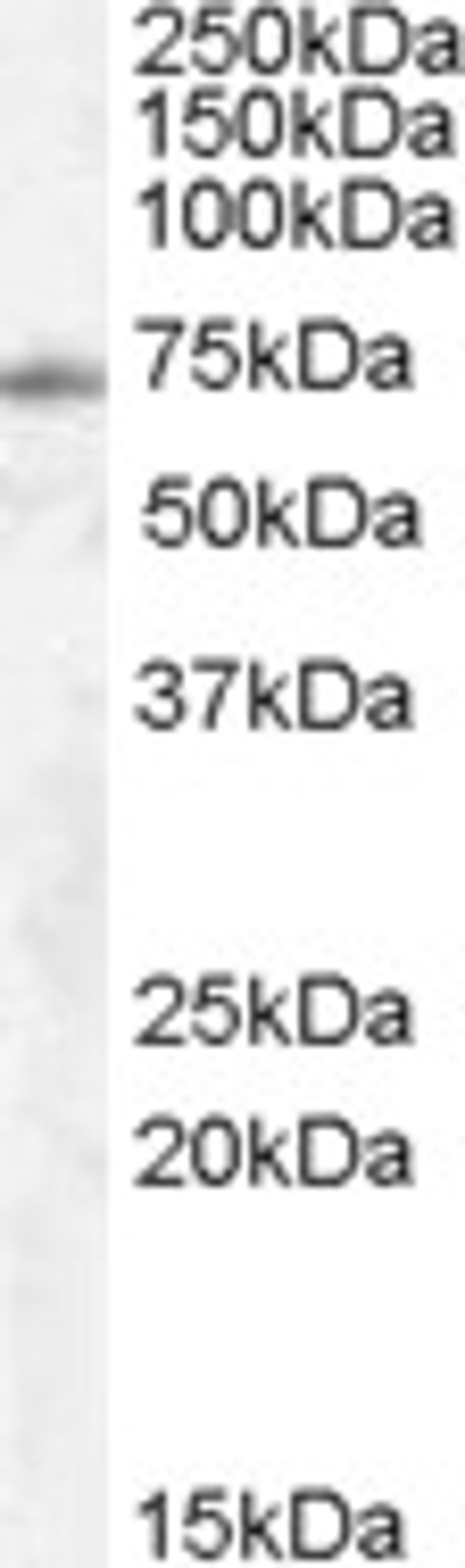 45-557 (0.5ug/ml) staining of Human Lung lysate (35ug protein in RIPA buffer). Primary incubation was 1 hour. Detected by chemiluminescence.