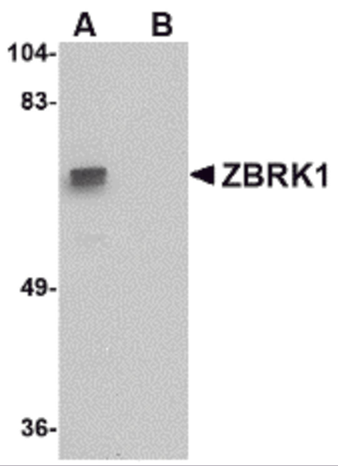 Western blot analysis of ZBRK1 in A-20 lysate with ZBRK1 antibody at 1 μg/mL in (A) the absence and (B) the presence of blocking peptide.