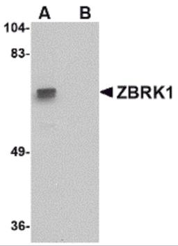 Western blot analysis of ZBRK1 in A-20 lysate with ZBRK1 antibody at 1 μg/mL in (A) the absence and (B) the presence of blocking peptide.