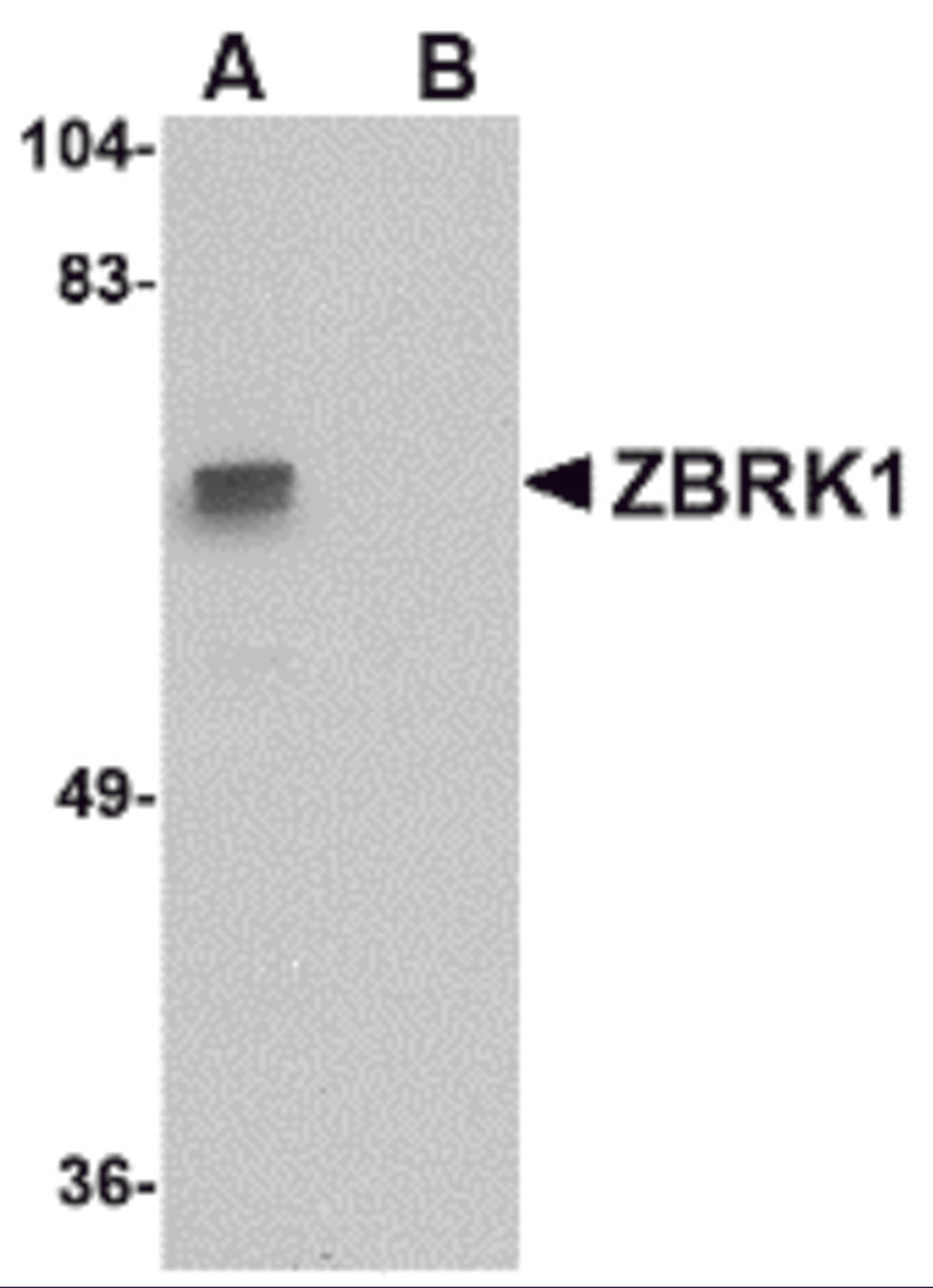Western blot analysis of ZBRK1 in A-20 lysate with ZBRK1 antibody at 1 μg/mL in (A) the absence and (B) the presence of blocking peptide.