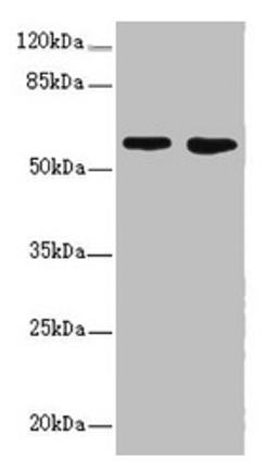 Western blot. All lanes: FLVCR2 antibody at 0.83µg/ml. Lane 1: A549 whole cell lysate. Lane 2: Mouse lung tissue. Secondary. Goat polyclonal to rabbit IgG at 1/10000 dilution. Predicted band size: 58, 36 kDa. Observed band size: 58 kDa