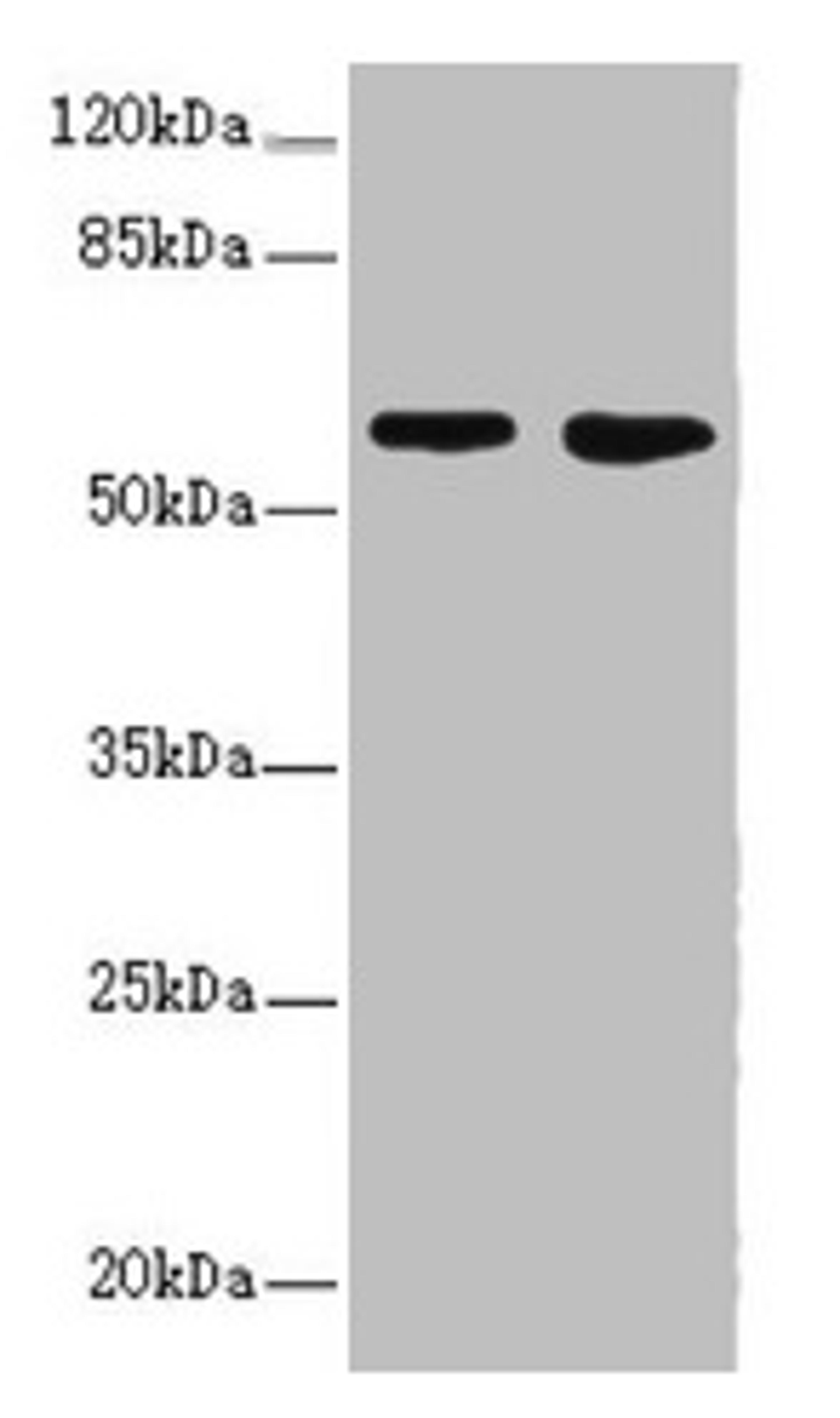 Western blot. All lanes: FLVCR2 antibody at 0.83µg/ml. Lane 1: A549 whole cell lysate. Lane 2: Mouse lung tissue. Secondary. Goat polyclonal to rabbit IgG at 1/10000 dilution. Predicted band size: 58, 36 kDa. Observed band size: 58 kDa