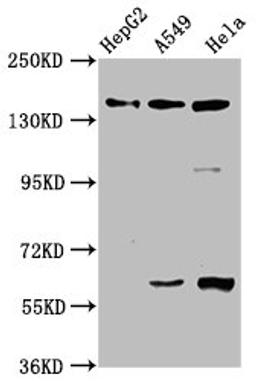 Western Blot. Positive WB detected in: HepG2 whole cell lysate, A549 whole cell lysate, Hela whole cell lysate. All lanes: NAIP antibody at 3.3µg/ml. Secondary. Goat polyclonal to rabbit IgG at 1/50000 dilution. Predicted band size: 160, 142 kDa. Observed band size: 160 kDa