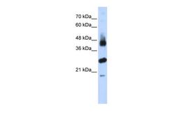 Antibody used in WB on Transfected 293T at 0.2-1 ug/ml.