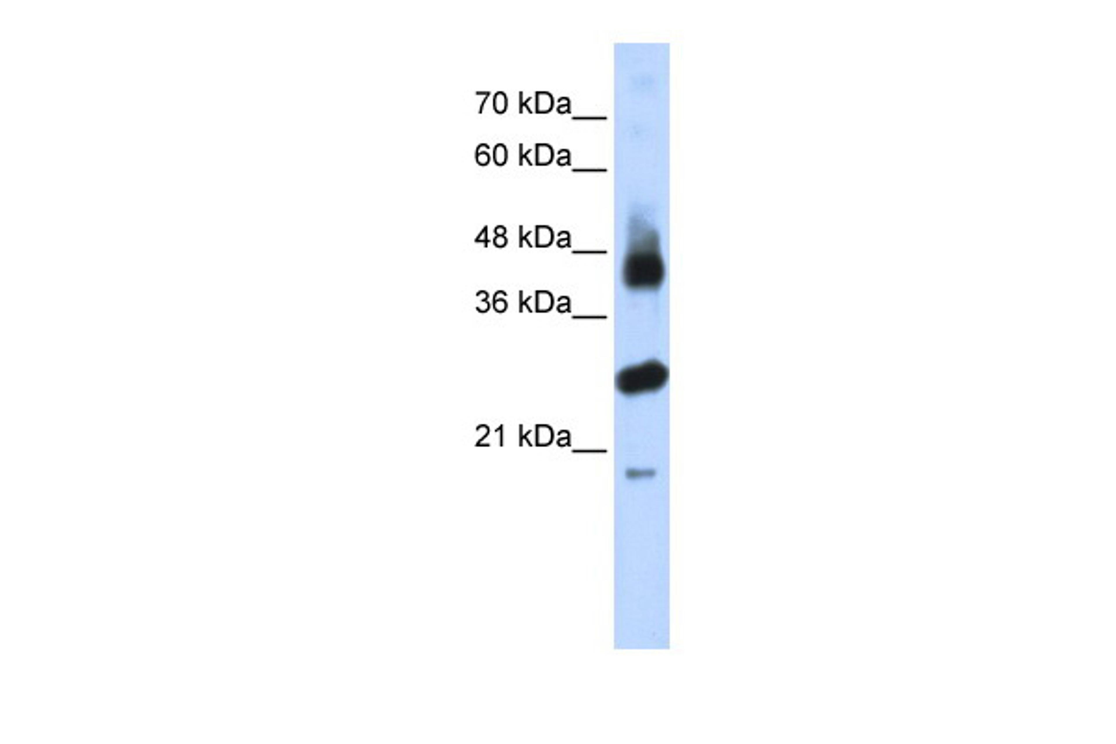 Antibody used in WB on Transfected 293T at 0.2-1 ug/ml.