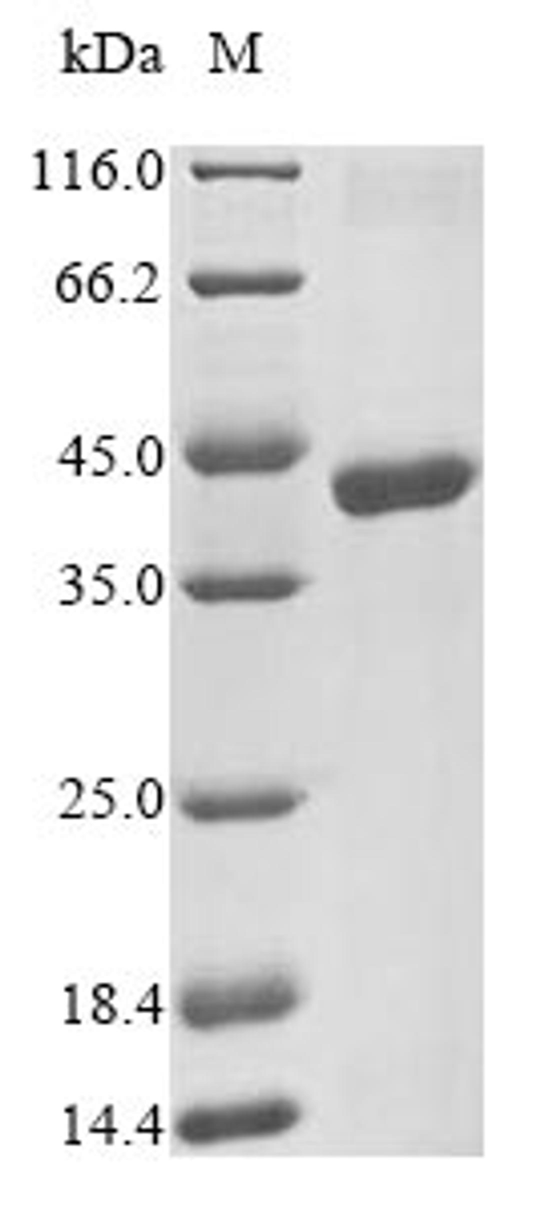 (Tris-Glycine gel) Discontinuous SDS-PAGE (reduced) with 5% enrichment gel and 15% separation gel.