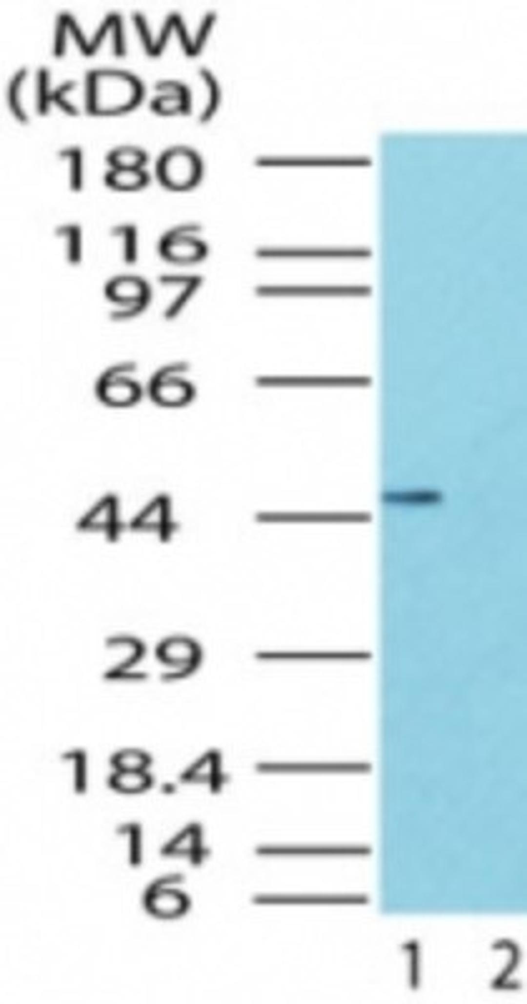 Western Blot: TRBP Antibody [NB100-56471] - Analysis of TRBP2 in the 1) absence and 2) presence of immunizing peptide in human brain lysate using this antibody at 0.5 ug/ml.