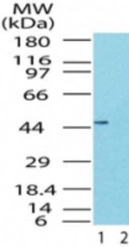 Western Blot: TRBP Antibody [NB100-56471] - Analysis of TRBP2 in the 1) absence and 2) presence of immunizing peptide in human brain lysate using this antibody at 0.5 ug/ml.