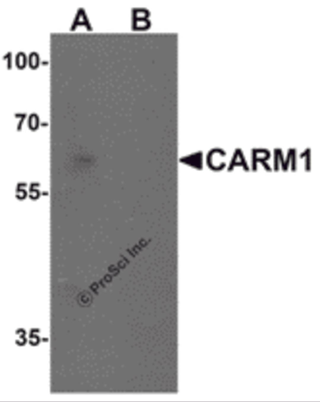 Western blot analysis of CARM1 in Jurkat cell lysate with CARM1 antibody at 1 μg/mL in (A) the absence and (B) the presence of blocking peptide.