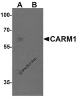 Western blot analysis of CARM1 in Jurkat cell lysate with CARM1 antibody at 1 μg/mL in (A) the absence and (B) the presence of blocking peptide.
