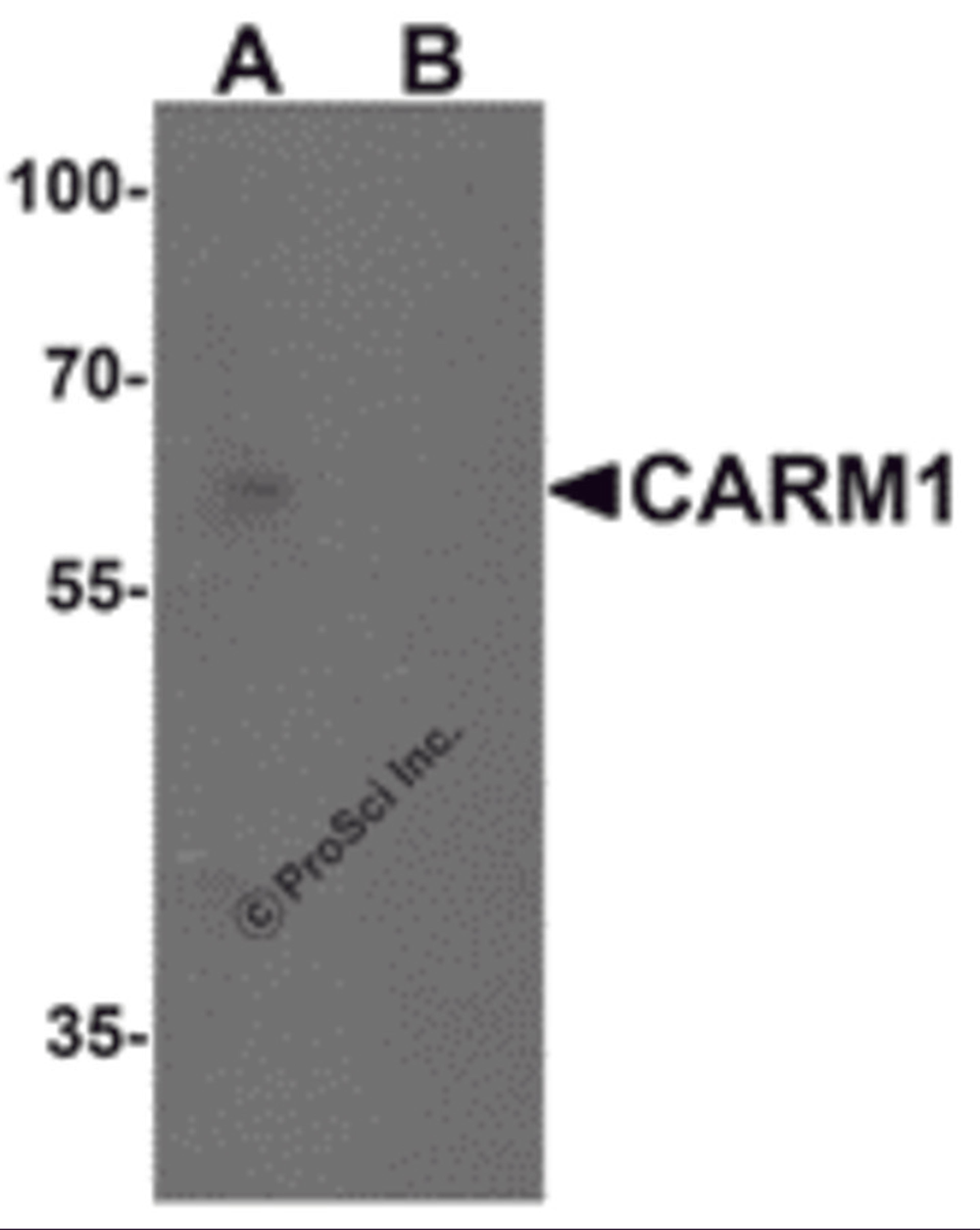 Western blot analysis of CARM1 in Jurkat cell lysate with CARM1 antibody at 1 μg/mL in (A) the absence and (B) the presence of blocking peptide.