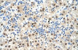 Antibody used in IHC on Human Liver cell lysates.