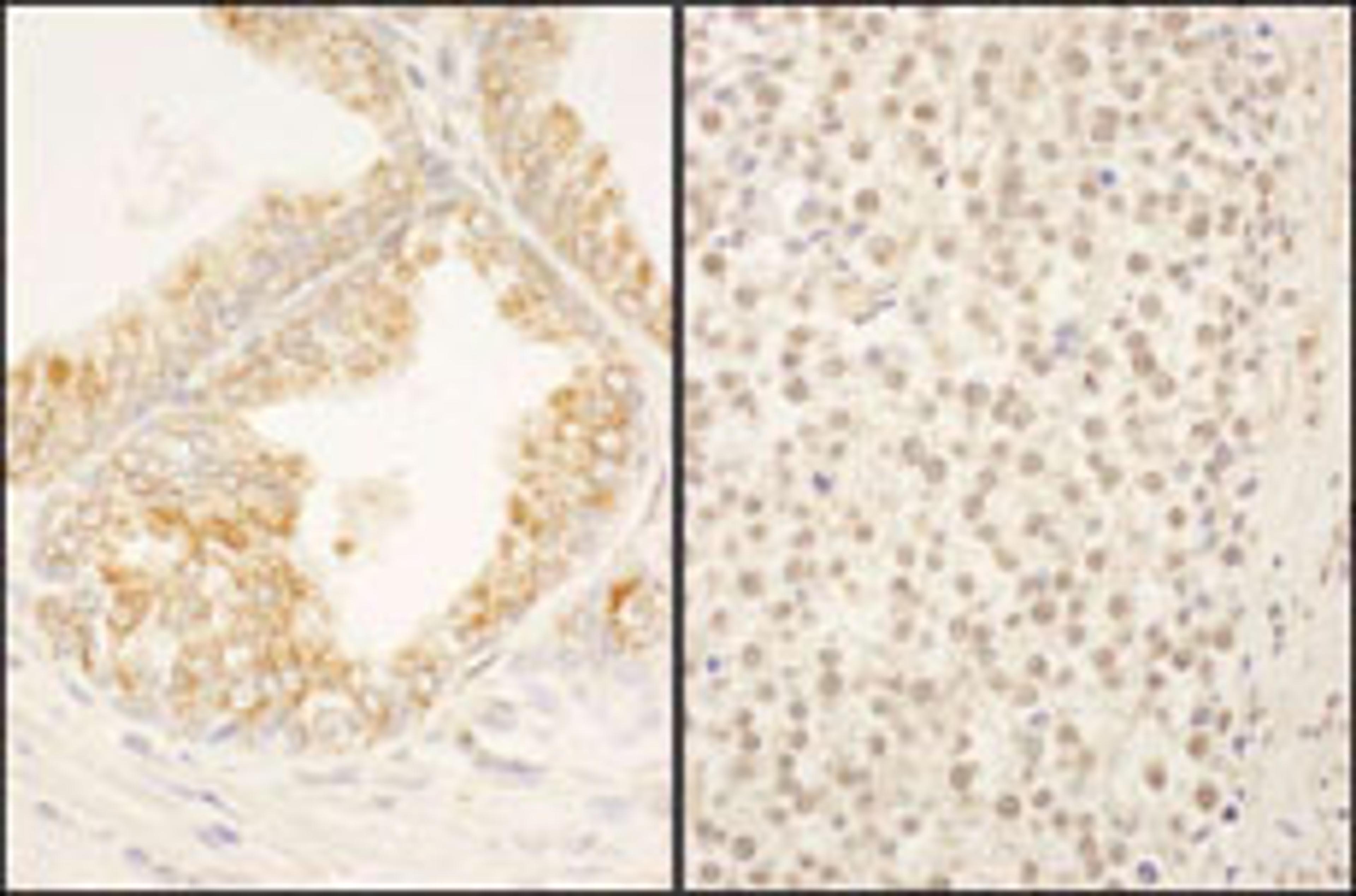 Detection of human FBXO38 by immunohistochemistry.