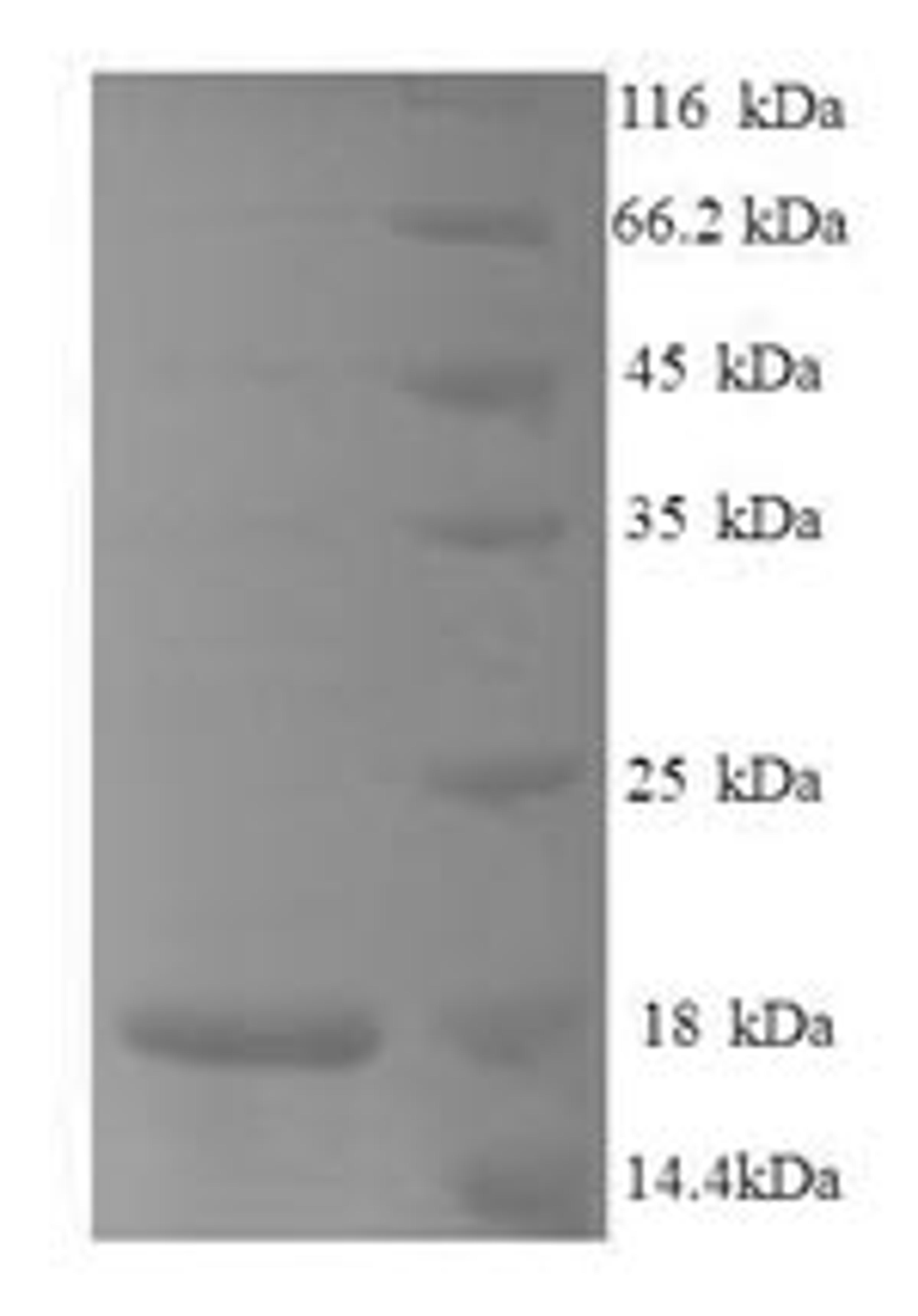 (Tris-Glycine gel) Discontinuous SDS-PAGE (reduced) with 5% enrichment gel and 15% separation gel.