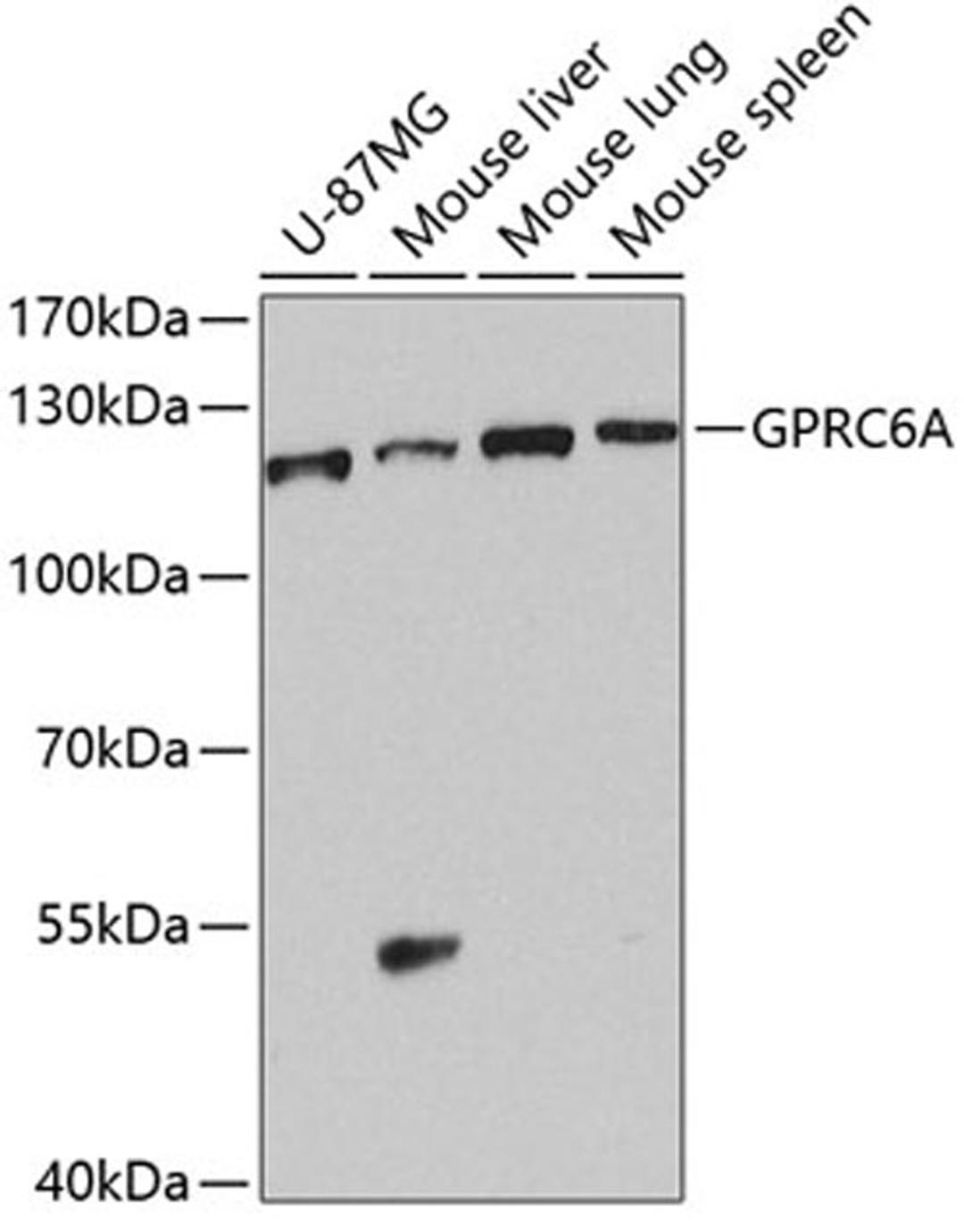 Western blot - GPRC6A antibody (A8525)