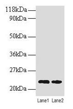 Western blot. All lanes: TAGLN antibody at 2µg/ml. Lane 1: EC109 whole cell lysate. Lane 2: 293T whole cell lysate. Secondary. Goat polyclonal to rabbit IgG at 1/15000 dilution. Predicted band size: 23 kDa. Observed band size: 23 kDa
