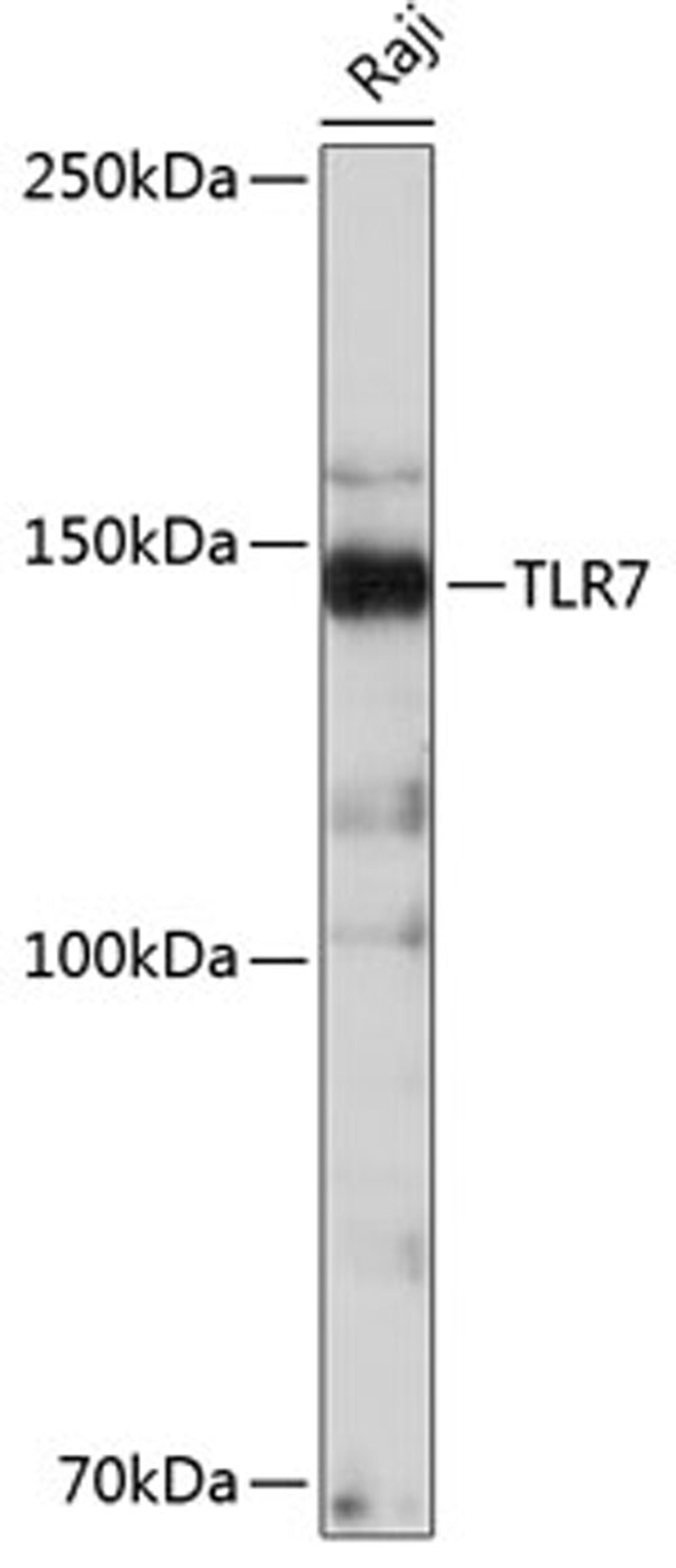 Western blot - TLR7 antibody (A19126)