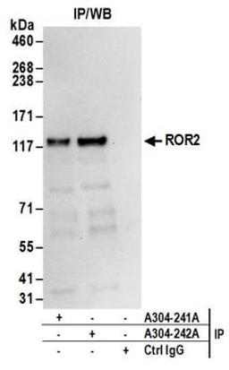 Detection of human ROR2 by western blot of immunoprecipitates.