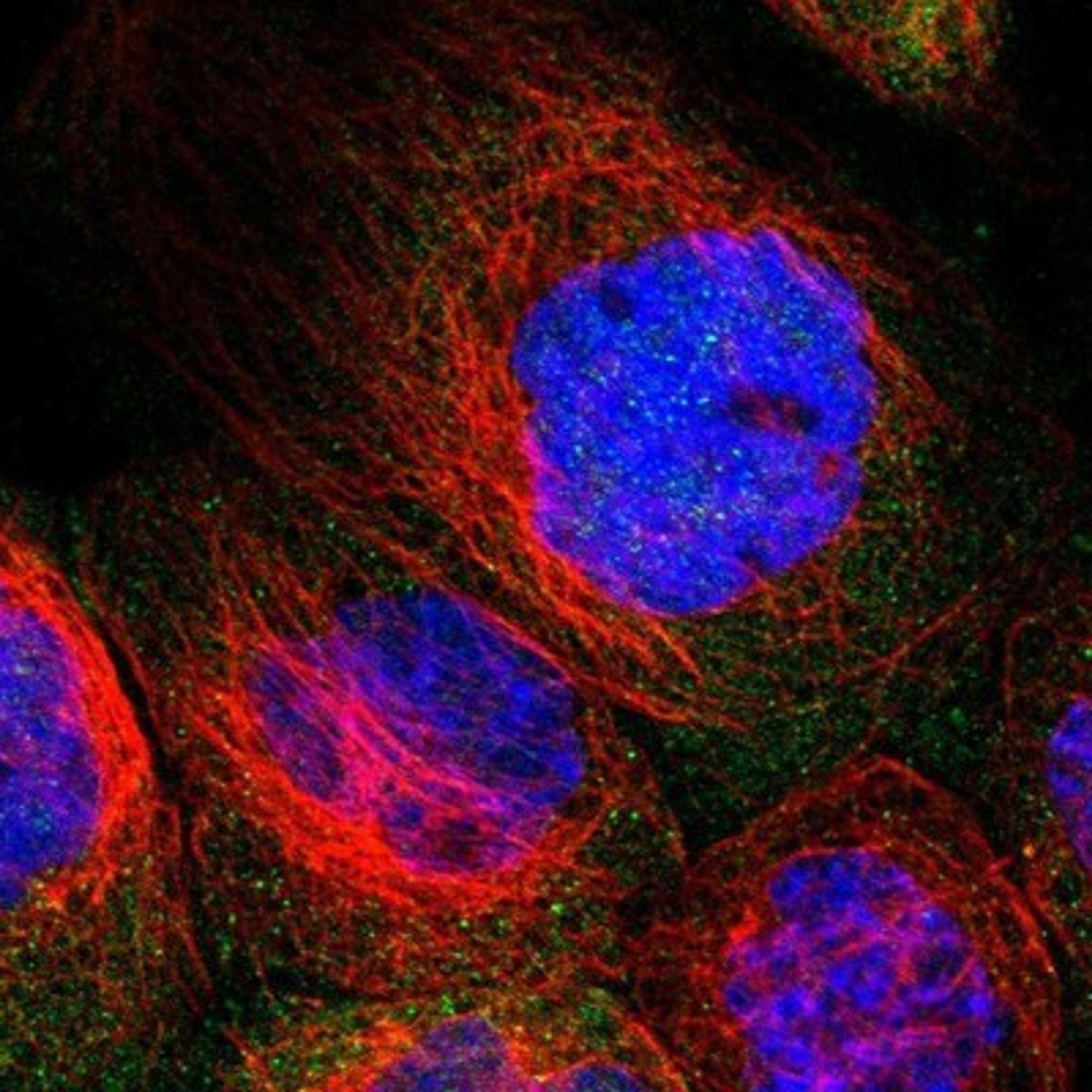 Immunocytochemistry/Immunofluorescence: ZAK Antibody [NBP1-90367] - Staining of human cell line A-431 shows positivity in cytoplasm.