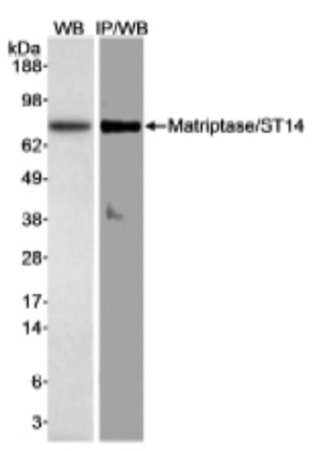 Western Blot: ST14 Antibody [NB100-2308] - Detection of human Matriptase/ST14 on HeLa whole cell lysate using NB100-2308.