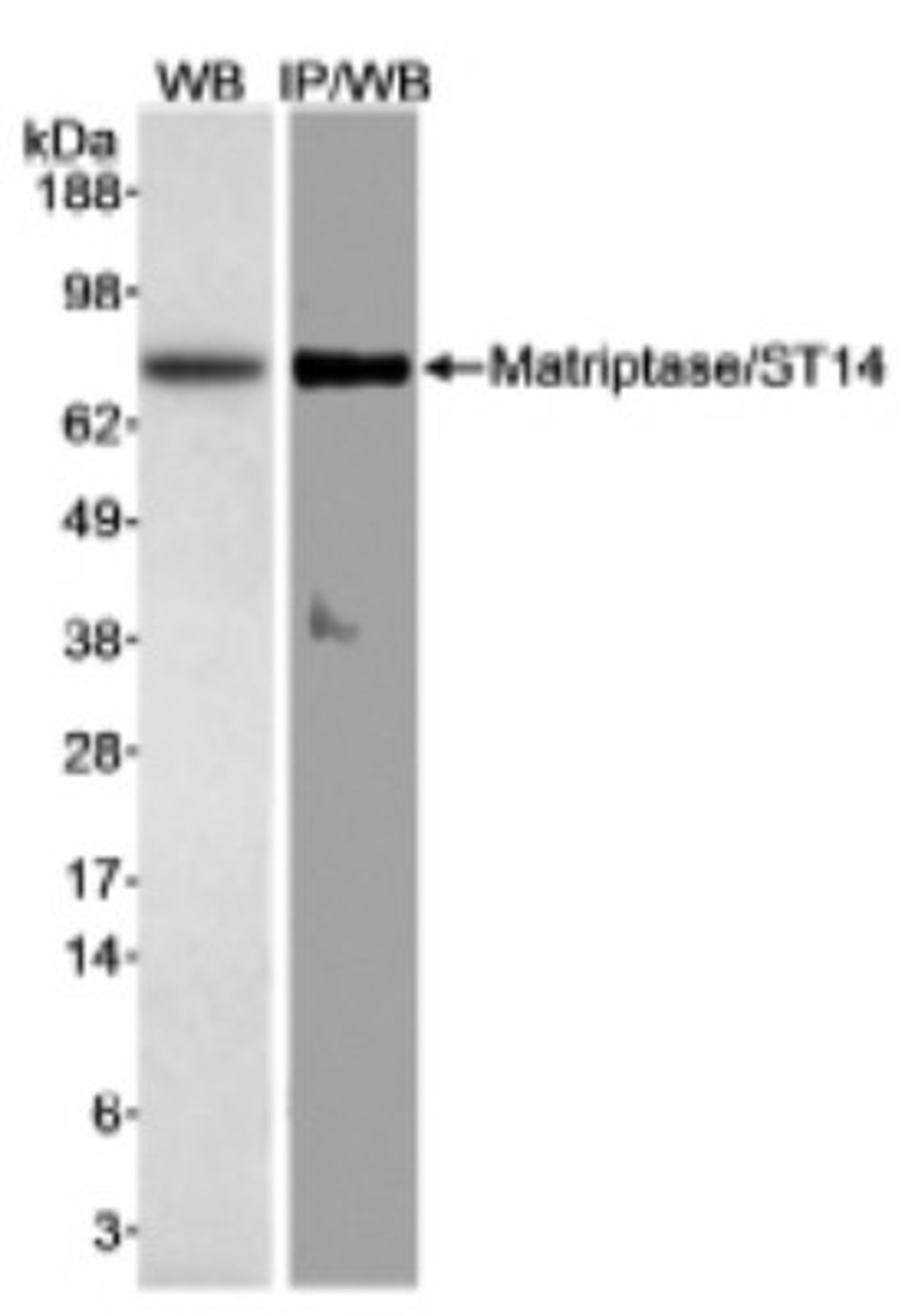 Western Blot: ST14 Antibody [NB100-2308] - Detection of human Matriptase/ST14 on HeLa whole cell lysate using NB100-2308.