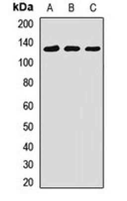 Western blot analysis of Hela (Lane1), A549 (Lane2), HT1080 (Lane3) whole cell lysates using SMARCA1 antibody