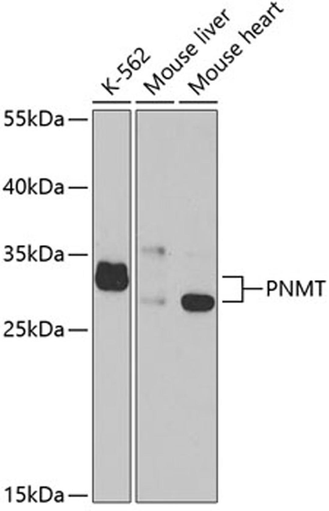 Western blot - PNMT antibody (A5553)