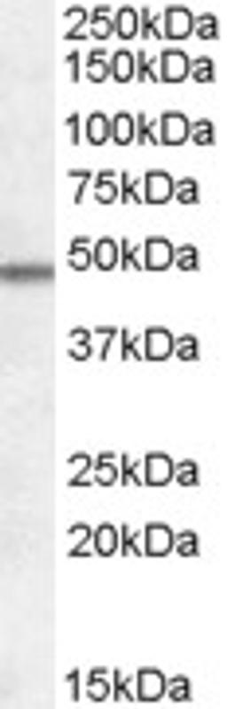 46-119 (0.5ug/ml) staining of Human Frontal Cortex lysate (35ug protein in RIPA buffer). Primary incubation was 1 hour. Detected by chemiluminescence.