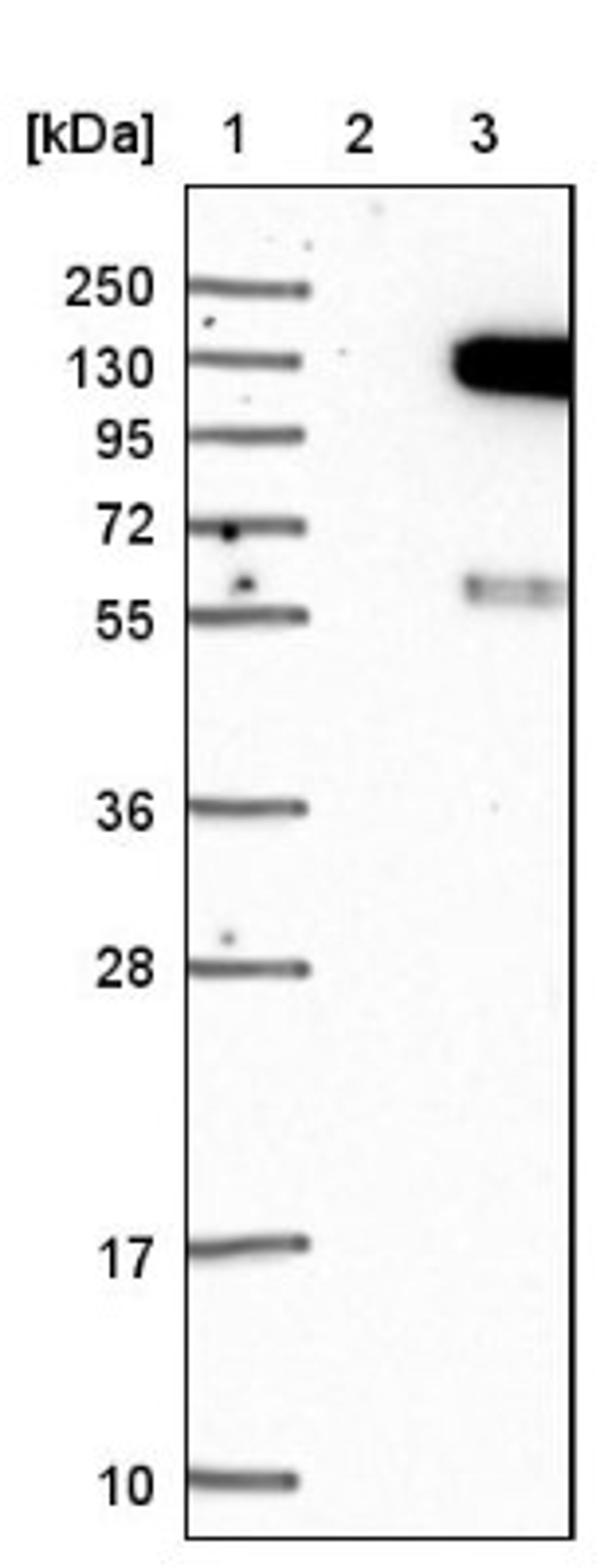 Western Blot: JIK Antibody [NBP1-84988] - Lane 1: Marker [kDa] 250, 130, 95, 72, 55, 36, 28, 17, 10<br/>Lane 2: Negative control (vector only transfected HEK293T lysate)<br/>Lane 3: Over-expression lysate (Co-expressed with a C-terminal myc-DDK tag (~3.1 kDa) in mammalian HEK293T cells, LY414078)