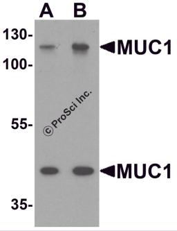 Western blot analysis of MUC1 in HeLa cell lysate with MUC1 antibody at (A) 1 and (B) 2 &#956;g/ml.