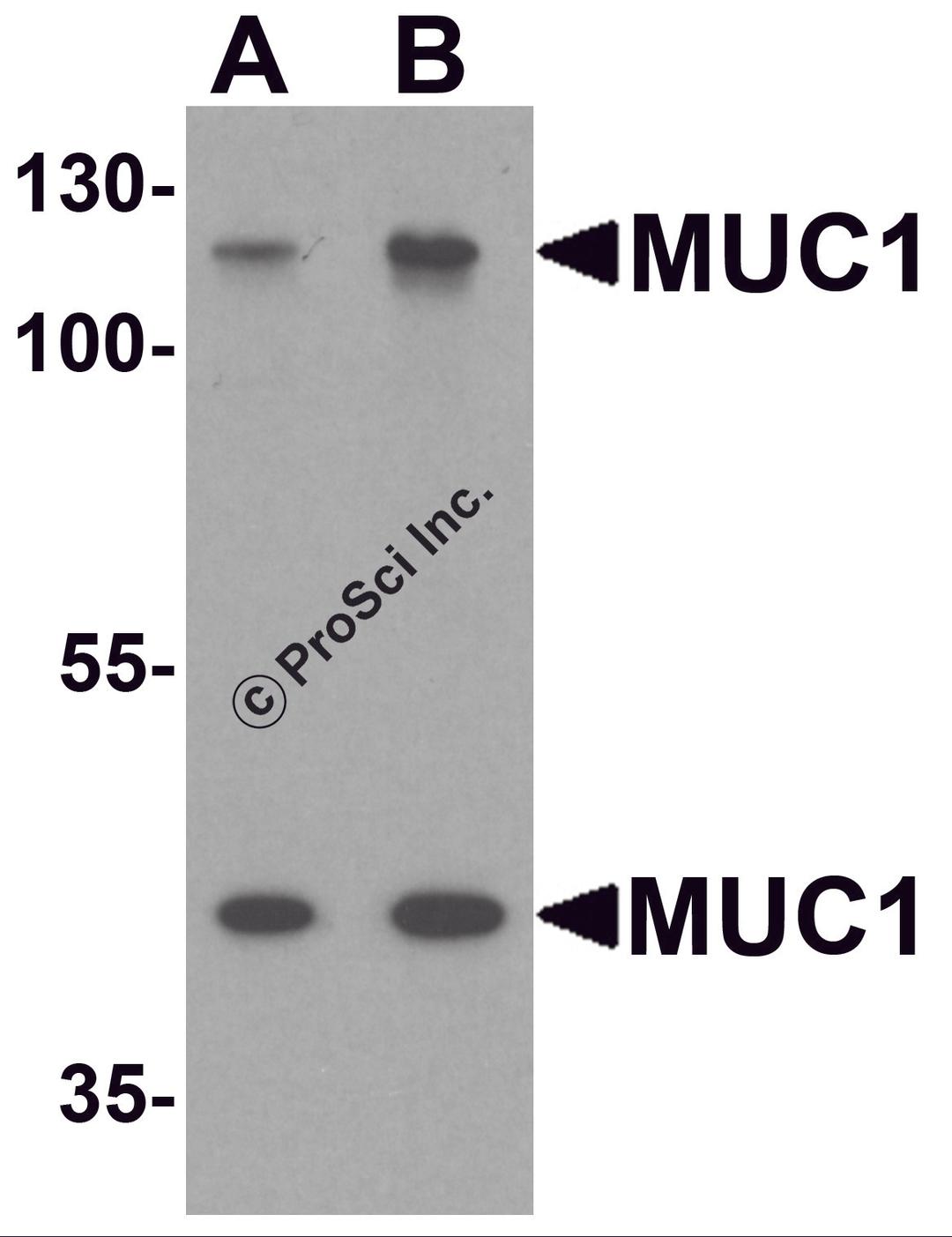 Western blot analysis of MUC1 in HeLa cell lysate with MUC1 antibody at (A) 1 and (B) 2 μg/ml.