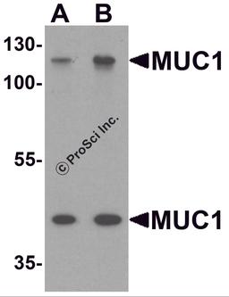 Western blot analysis of MUC1 in HeLa cell lysate with MUC1 antibody at (A) 1 and (B) 2 μg/ml.
