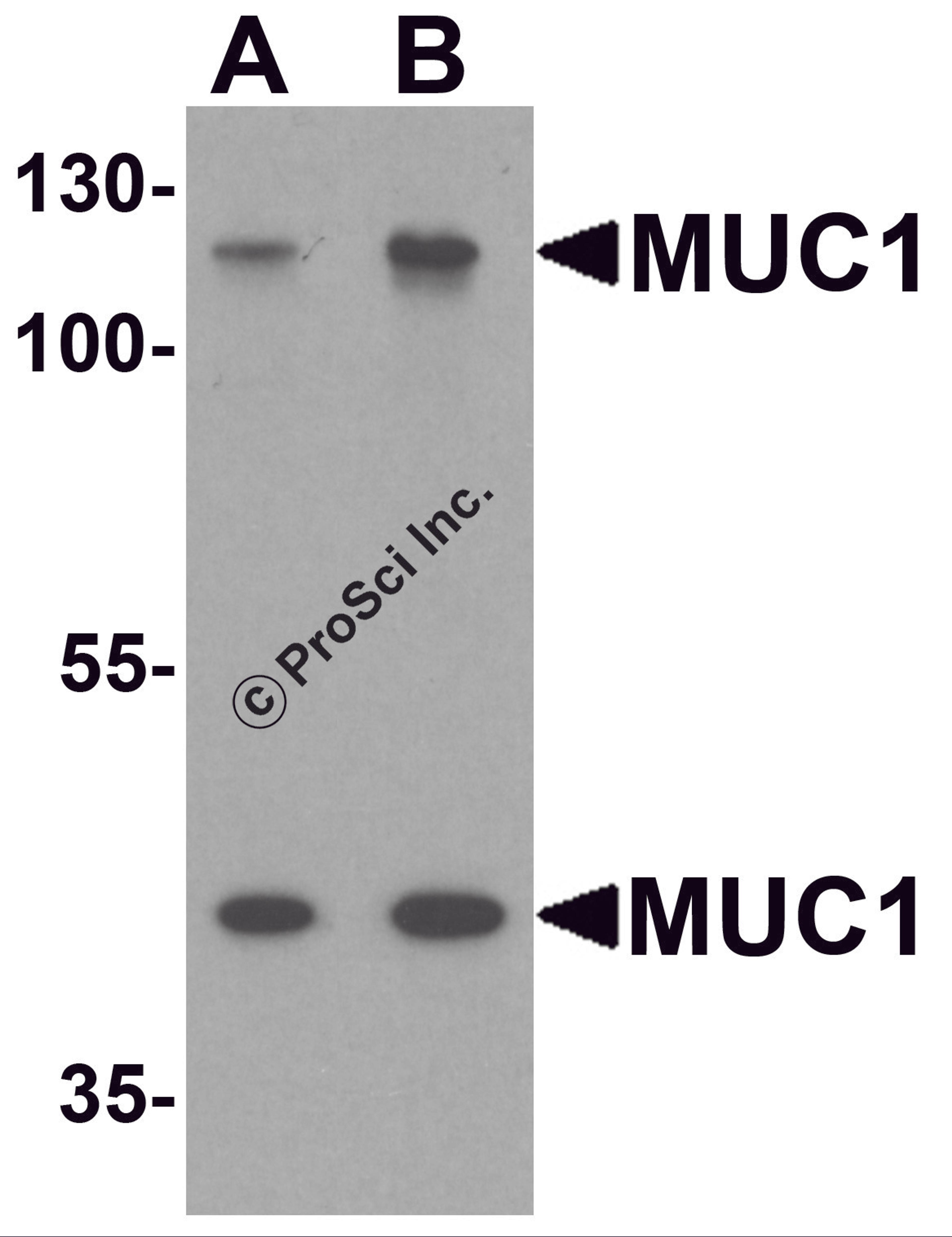 Western blot analysis of MUC1 in HeLa cell lysate with MUC1 antibody at (A) 1 and (B) 2 μg/ml.