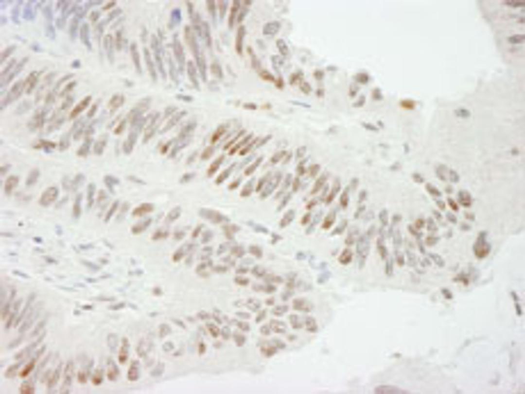 Detection of human ZBTB7/FBI-1 by immunohistochemistry.