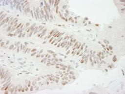 Detection of human ZBTB7/FBI-1 by immunohistochemistry.