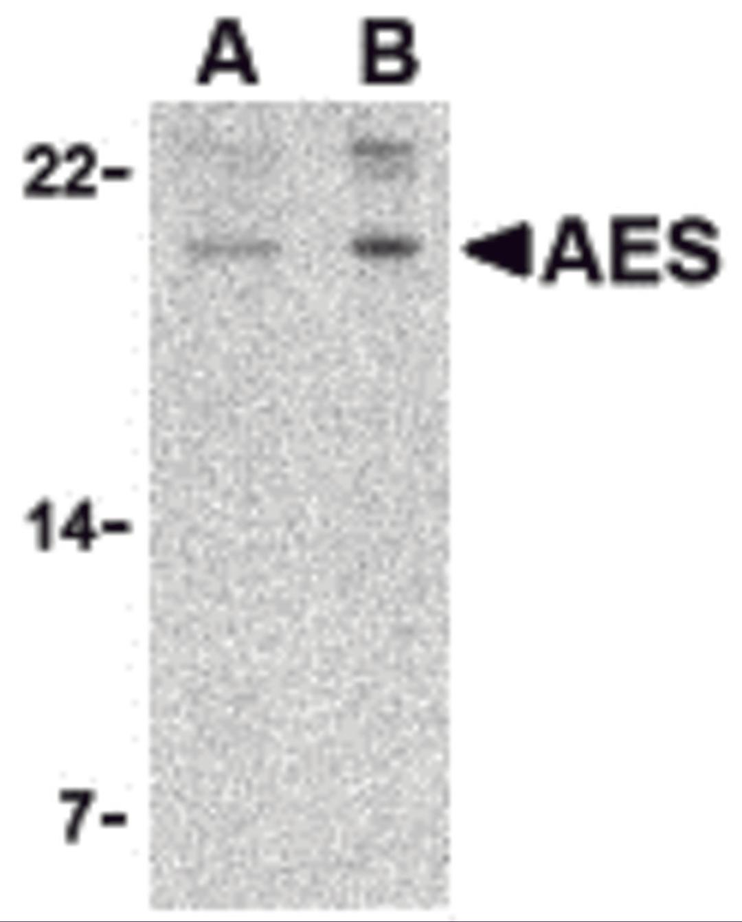 Western blot analysis of AES in 293 cell lysate with AES antibody at (A) 2 and (B) 4 μg/mL.