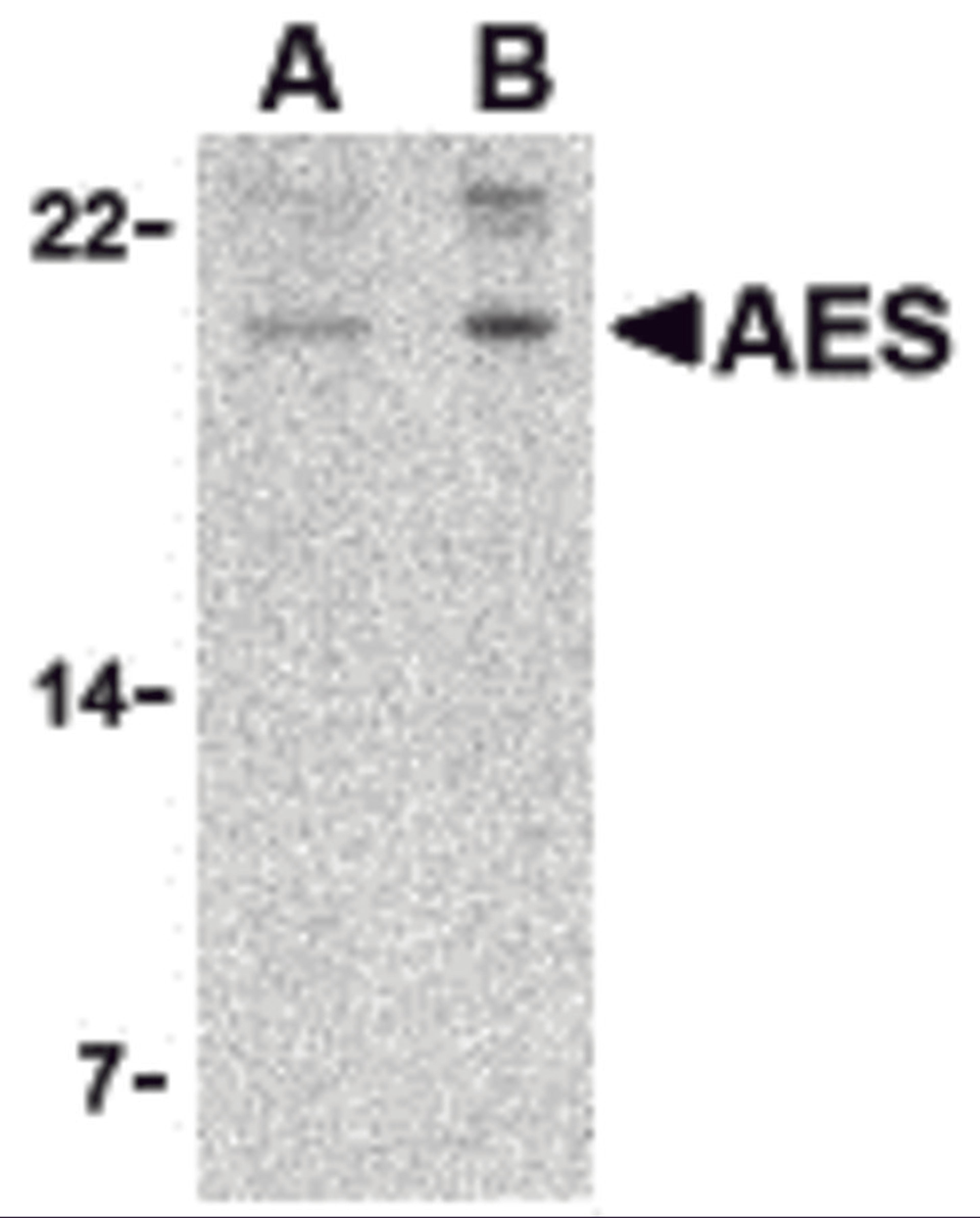 Western blot analysis of AES in 293 cell lysate with AES antibody at (A) 2 and (B) 4 μg/mL.