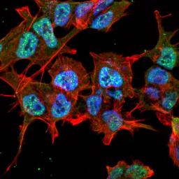 Immunofluorescence analysis of neuroblastoma cell line sk-n-be using GABA A Receptor antibody