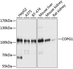 Western blot - COPG1 antibody (A10551)