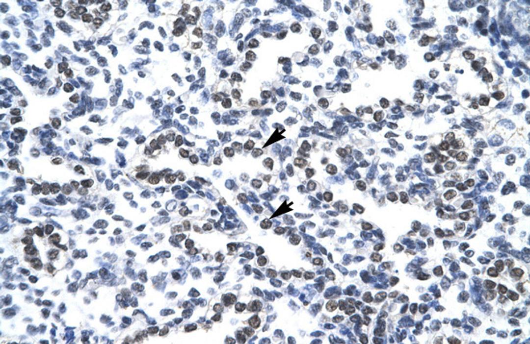 Antibody used in IHC on Human Lung.