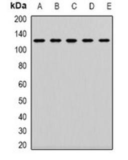 Western blot analysis of K562 (Lane 1), SW620 (Lane 2), Jurkat (Lane 3), mouse kidney (Lane 4), mouse lung (Lane 5) whole cell lysates using CD133 antibody