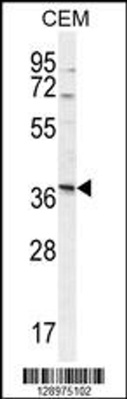 Western blot analysis in CEM cell line lysates (35ug/lane).